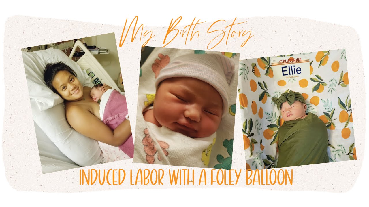 My Birth Story | Foley Balloon Induction