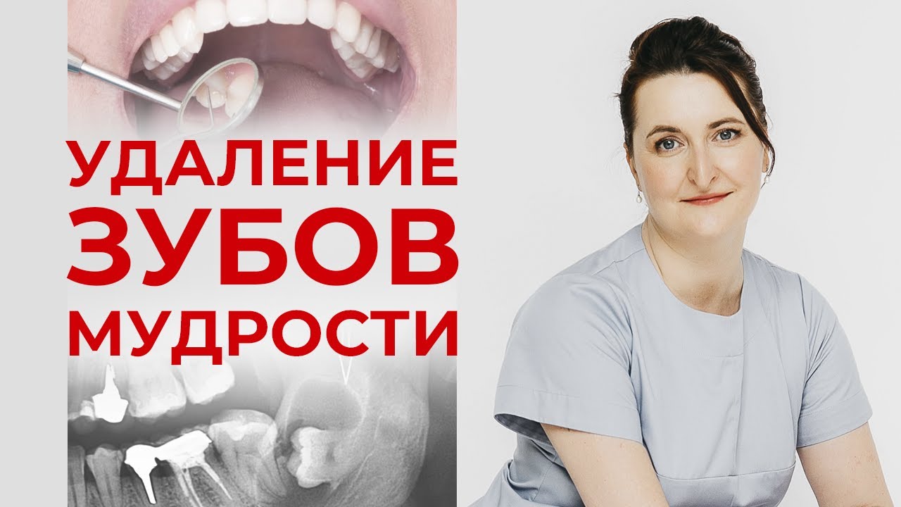 Удаление зуба мудрости / Интервью со стоматологом-хирургом