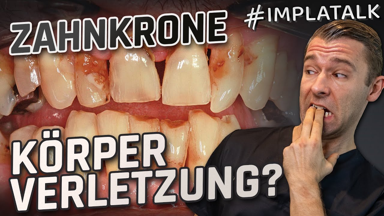 Was dir dein Zahnarzt NICHT über Kronen sagt 😳💥