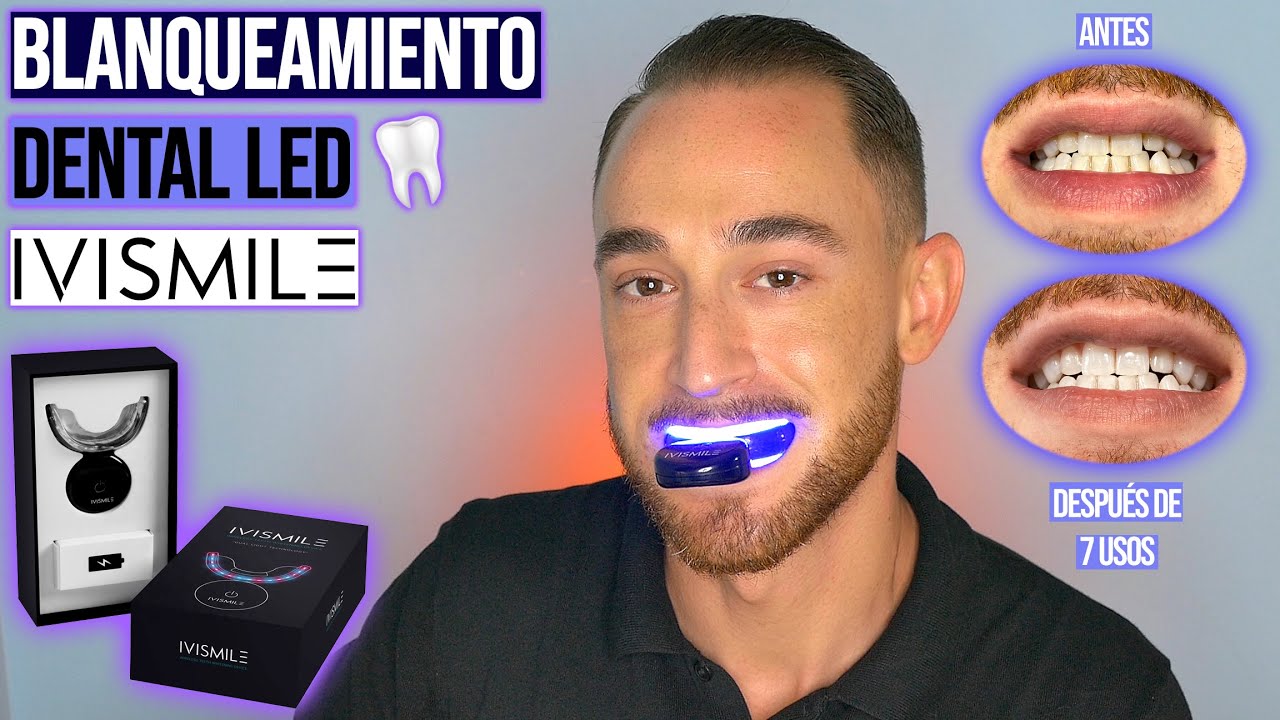 BLANQUEAMIENTO DENTAL CON LUZ LED