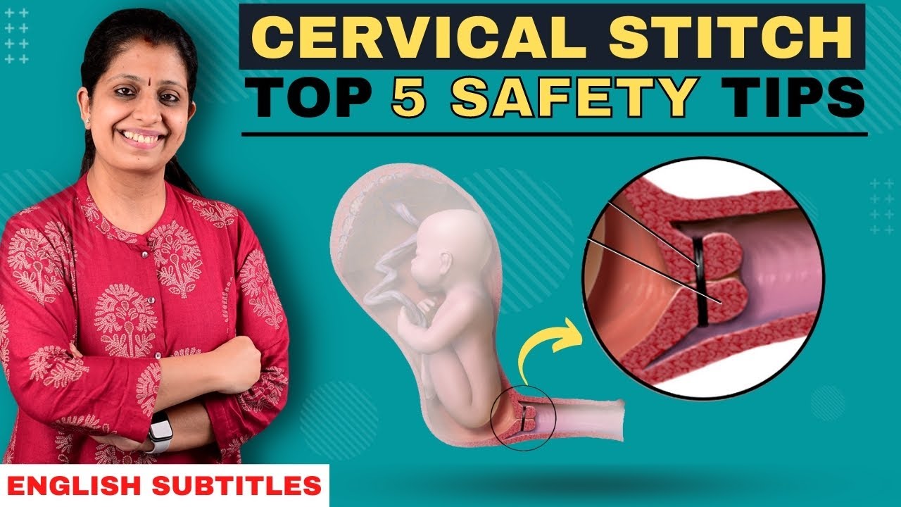 MUST KNOW - Stitched Cervix Dos & Don’ts I கர்ப்பப்பை தையல் போட்ட பிறகு செய்ய கூடியவை செய்ய கூடாதவை