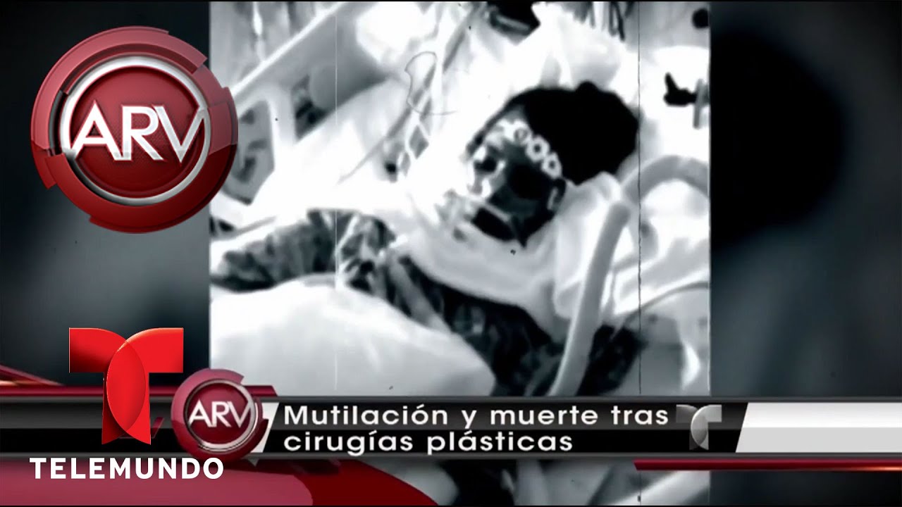 Mutilación y muerte tras cirugías plásticas | Al Rojo Vivo | Telemundo
