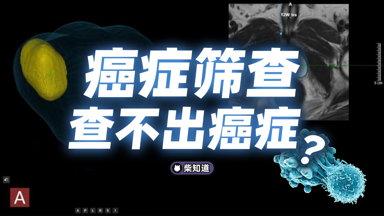 &ldquo;体检十年&rdquo;查不出癌症，癌症筛查还值得做吗？【柴知道】