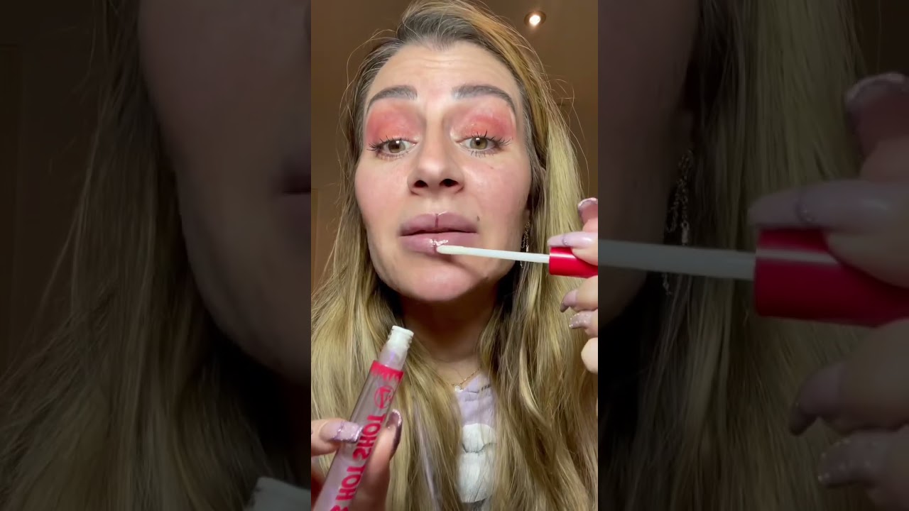 Technique pour doubler les l&egrave;vres de volumes !! Injection technique 💉🫦
