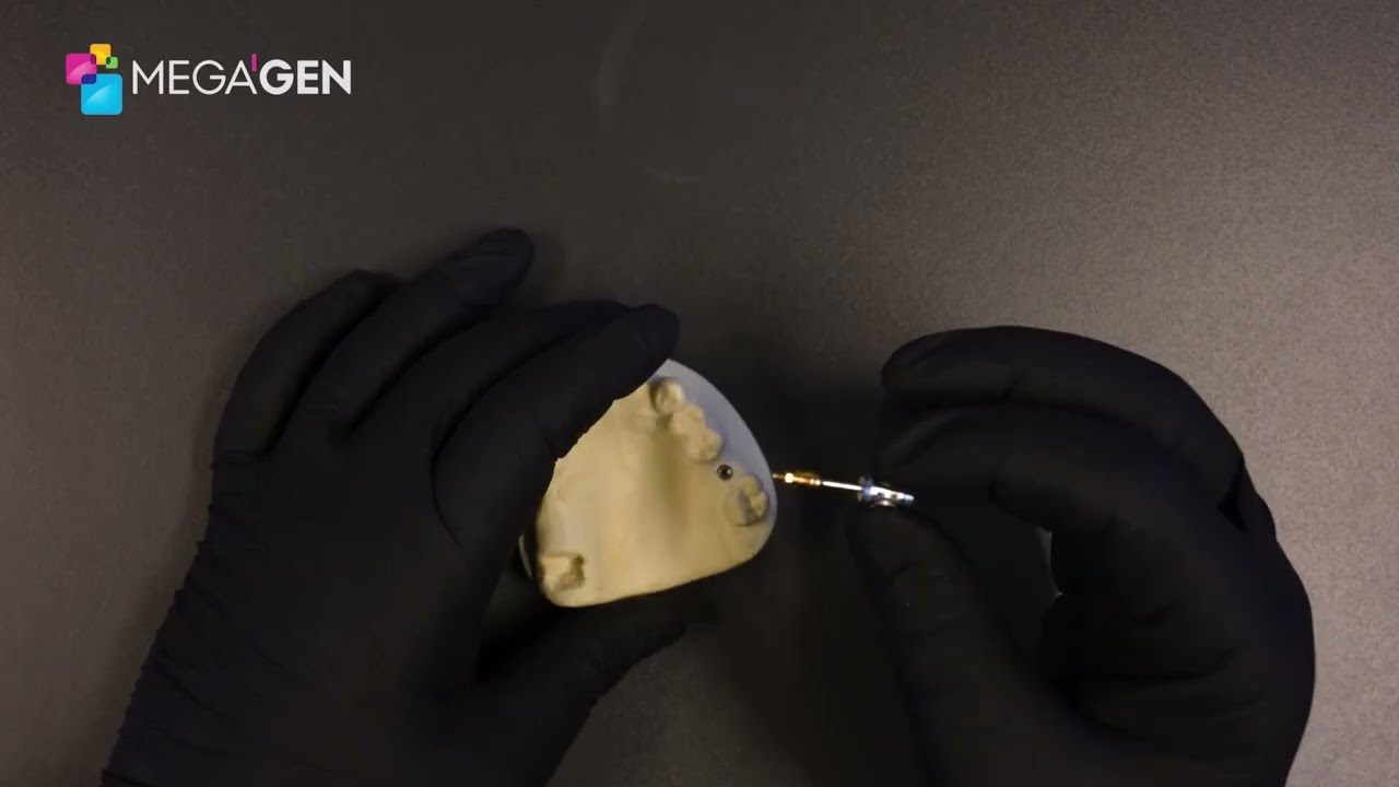 Scannable Healing Abutment - MegaGen UK
