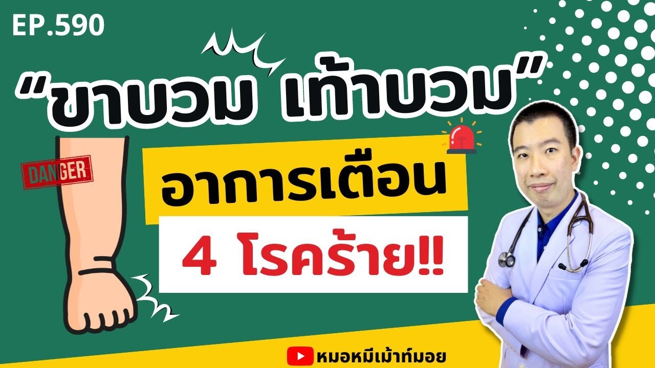 ขาบวม อาการเตือน 4 โรคอันตราย ที่คุณควรรู้ | เม้าท์กับหมอหมี EP.590