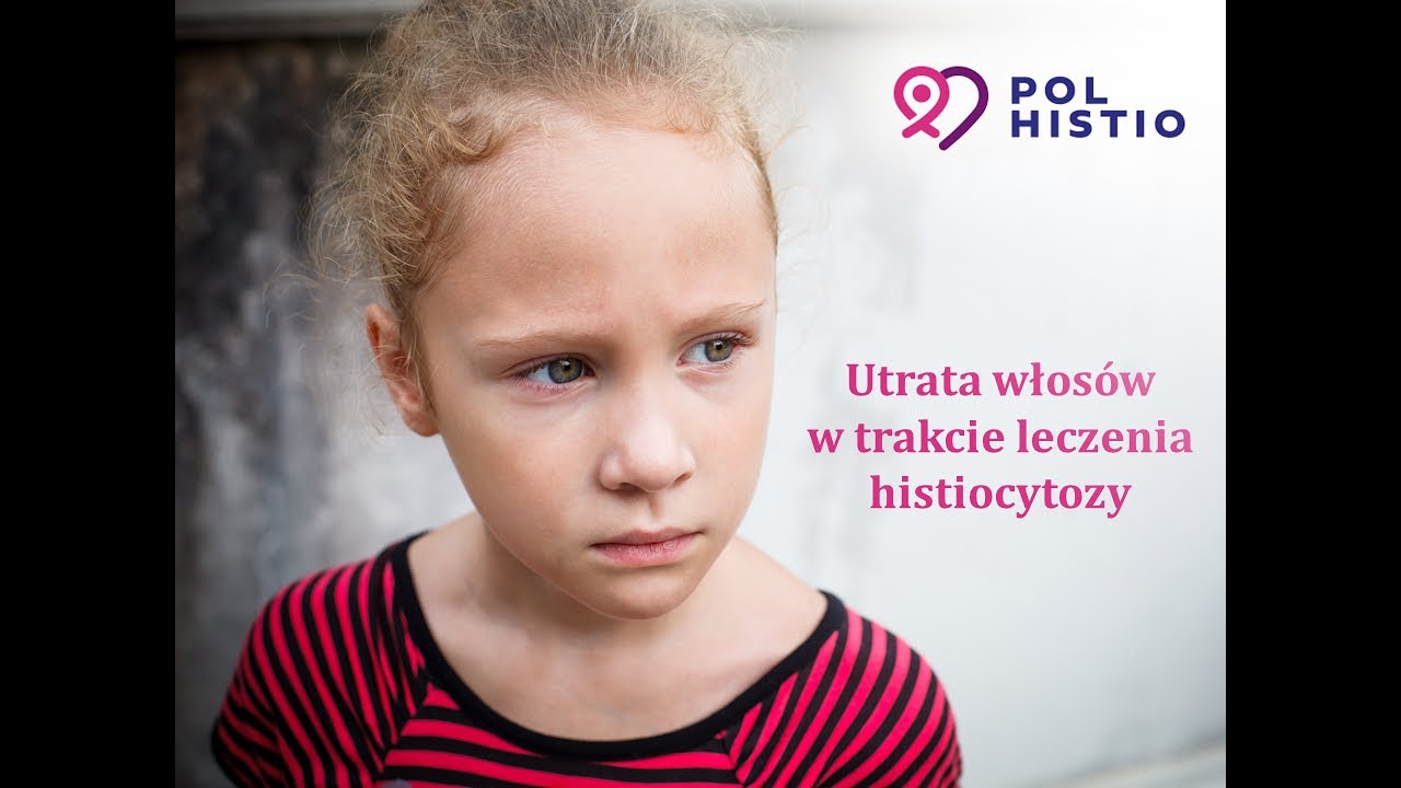 Utrata włosów w leczeniu histiocytozy