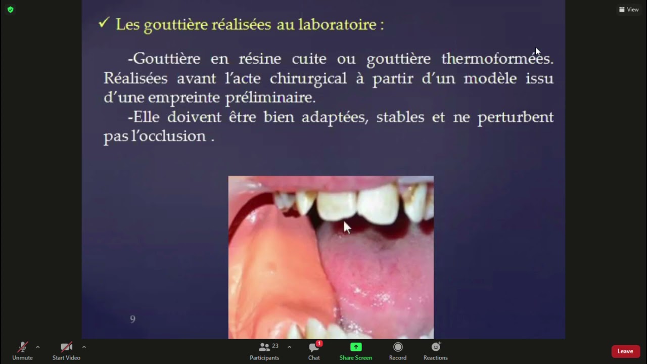 Techniques et moyens d'hémostase