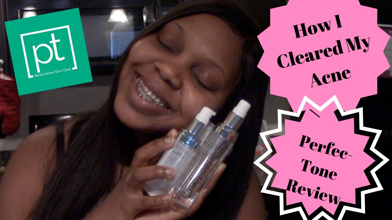 How to Clear Acne & MINIMIZE Pores With Perfec-Tone review