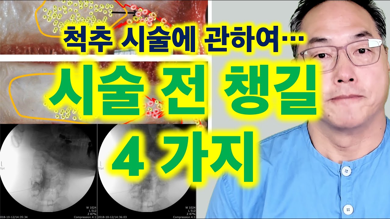 척추 시술에 관하여... 시술 전에 챙길 4 가지