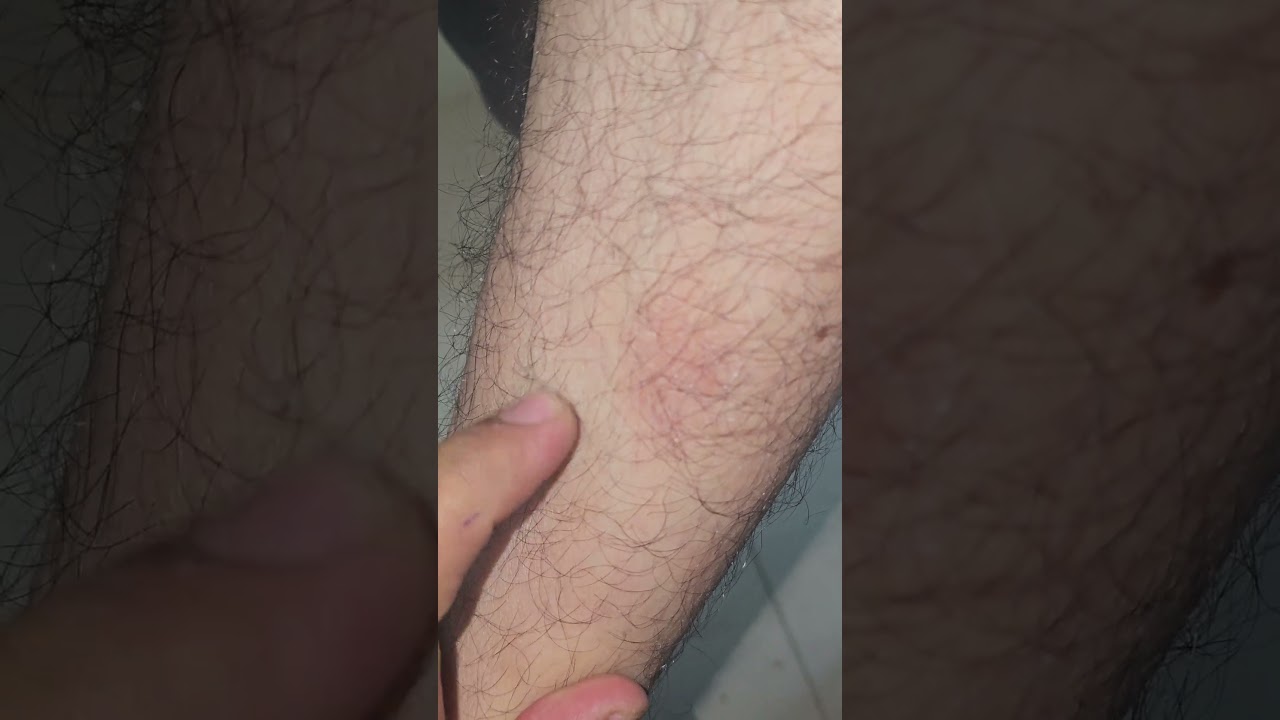 Spot Diagnosis 