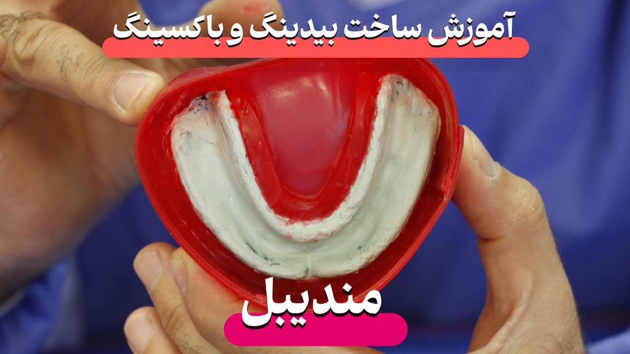 پروتز کامل - بیدینگ و باکسینگ برای مندیبل