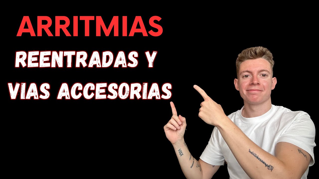 ARRITMIAS SUPRAVENTRICULARES: LO QUE NECESITAS SABER 😎