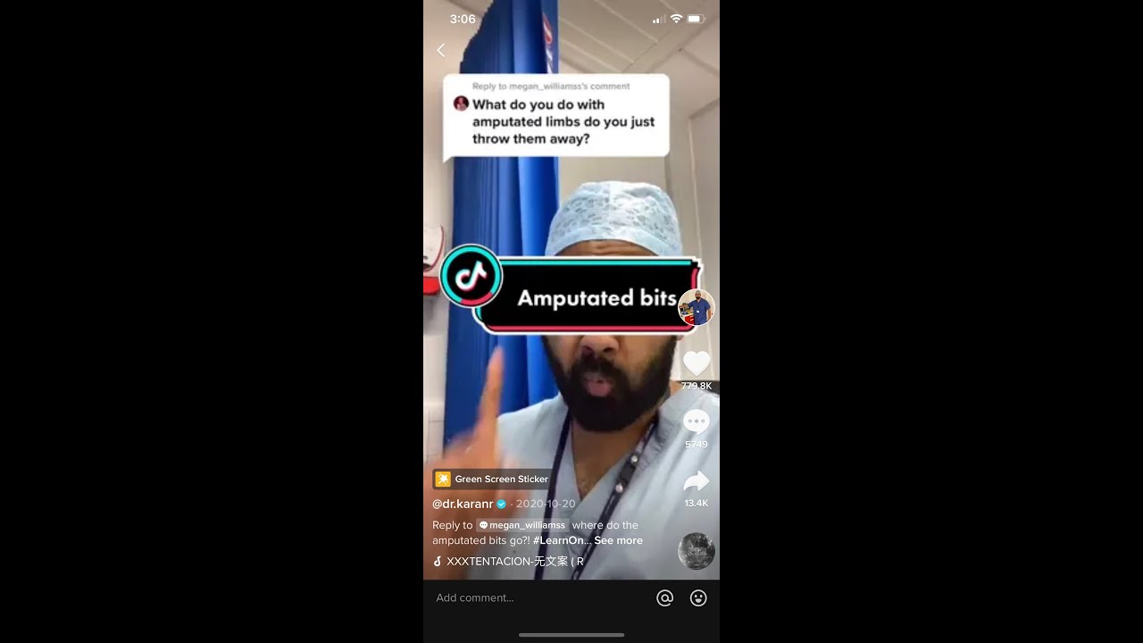 Doctor reacts to What happens to amputated limbs after surgery? #shorts