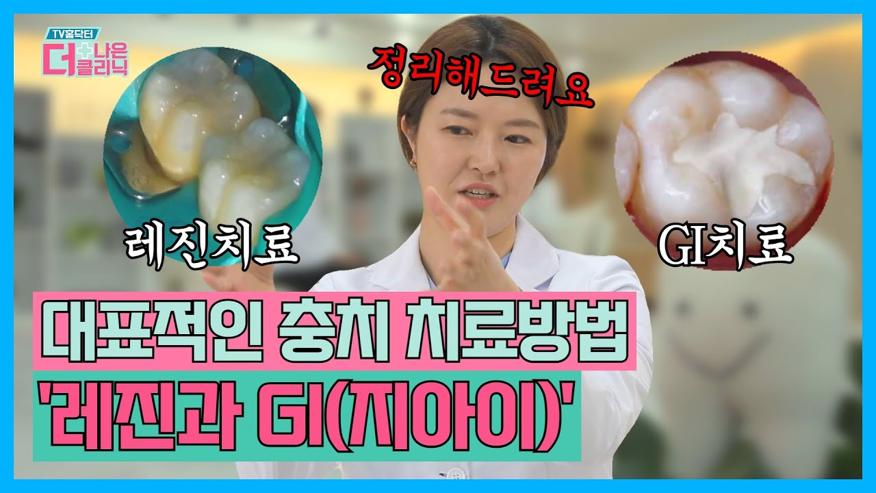 [티비홈닥터] 치과 대표적인 충치 치료방법 '레진과 GI(지아이)' / TV홈닥터 더 나은 클리닉 17회 / G1방송 / 20220614