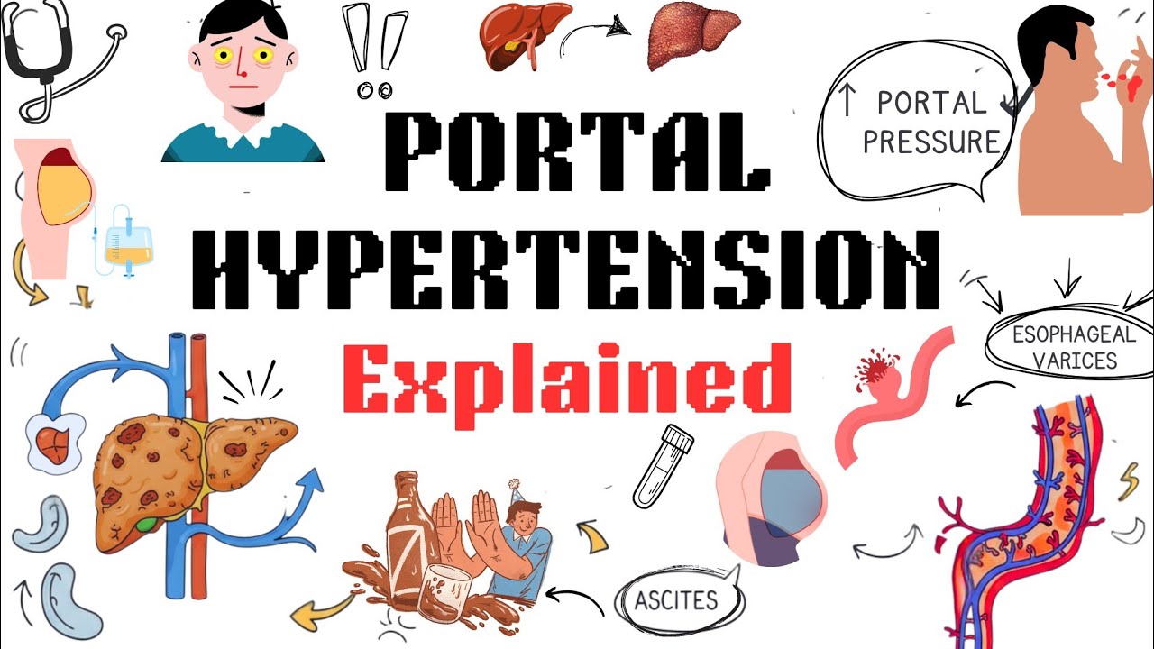 Portal Hypertension Explained Clearly in 4 Minutes | High-Yield Concept 