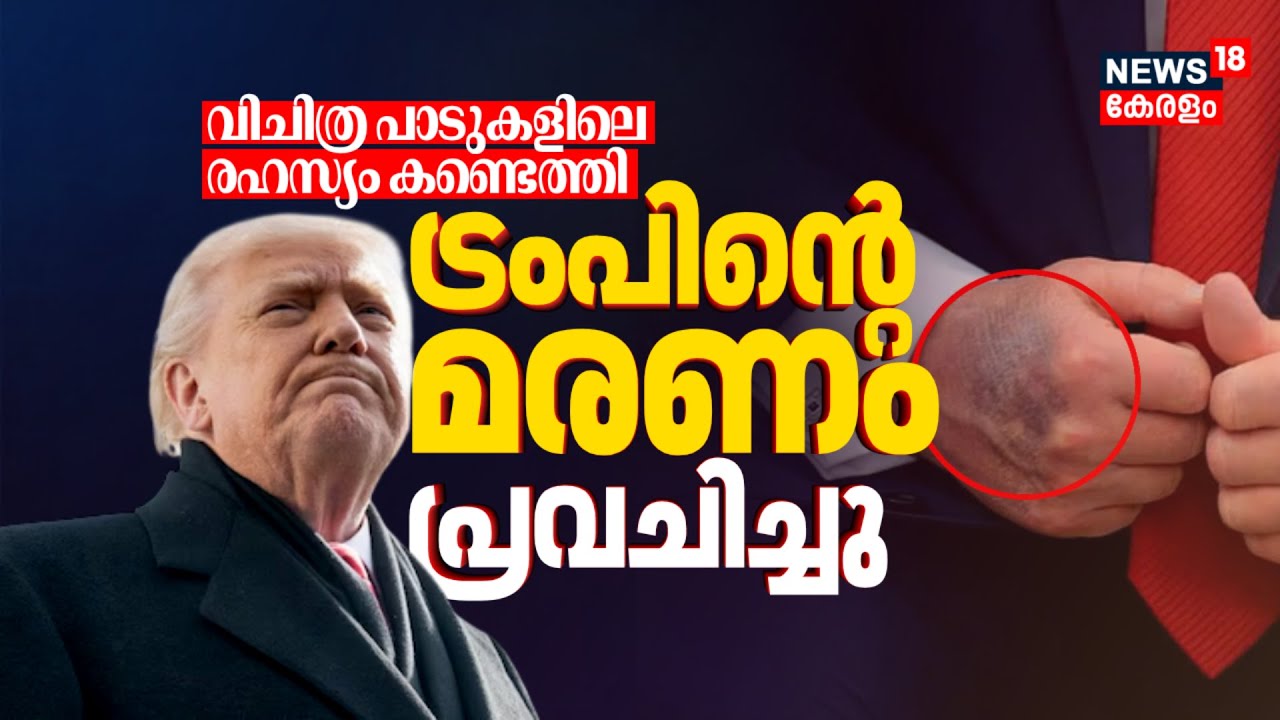 ട്രംപിൻ്റെ മരണം പ്രവചിച്ച് ഡോക്ടർമാർ; വിചിത്ര പാടുകൾക്ക് പിന്നിൽ | Trump Health Issues | N18G