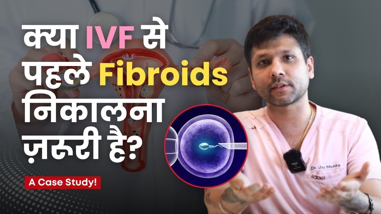Can You Proceed with IVF if You Have Fibroids? Case Study | Dr Jay Mehta: Shree IVF Clinic, Mumbai