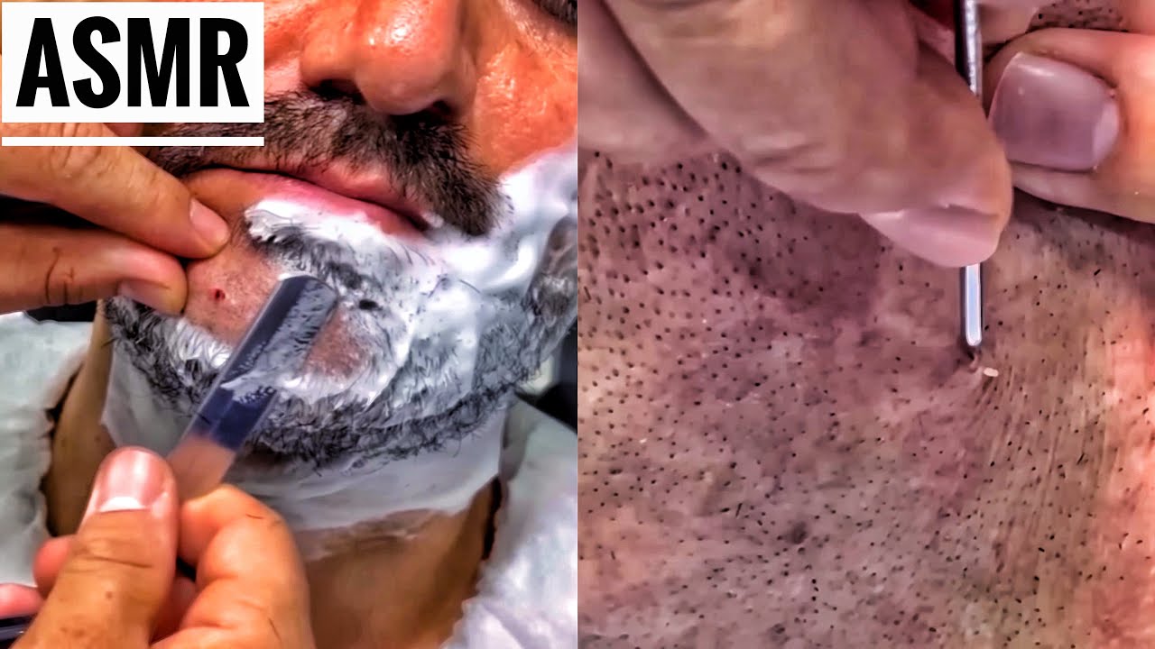 ASMR BEARD CUT AND ACNE REMOVAL • REMOVING ACNE FROM THE SKIN AND CLEANING PORES