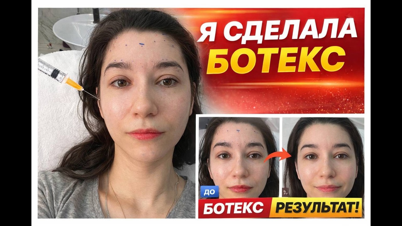 БОТЕКС мой опыт
