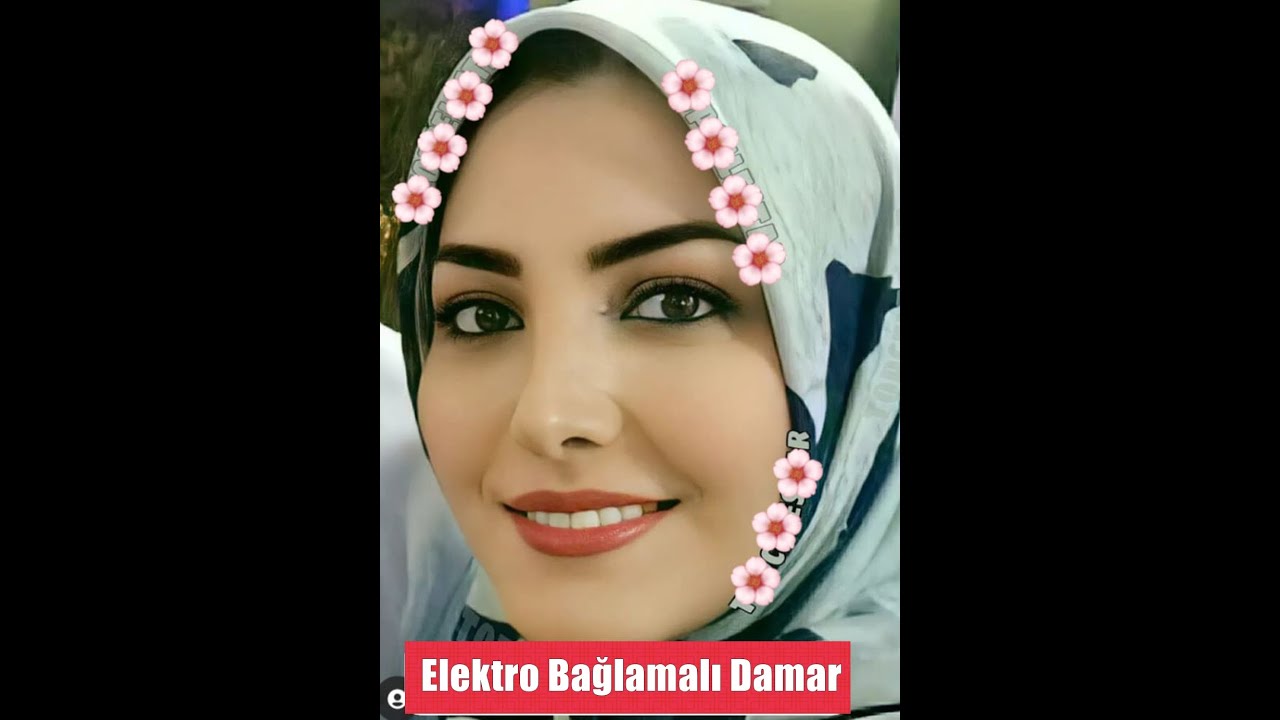 Kime Kin Ettin Giydin Alları - Elektro Bağlamalı Damar - Amasyalı Ferhat Türküleri