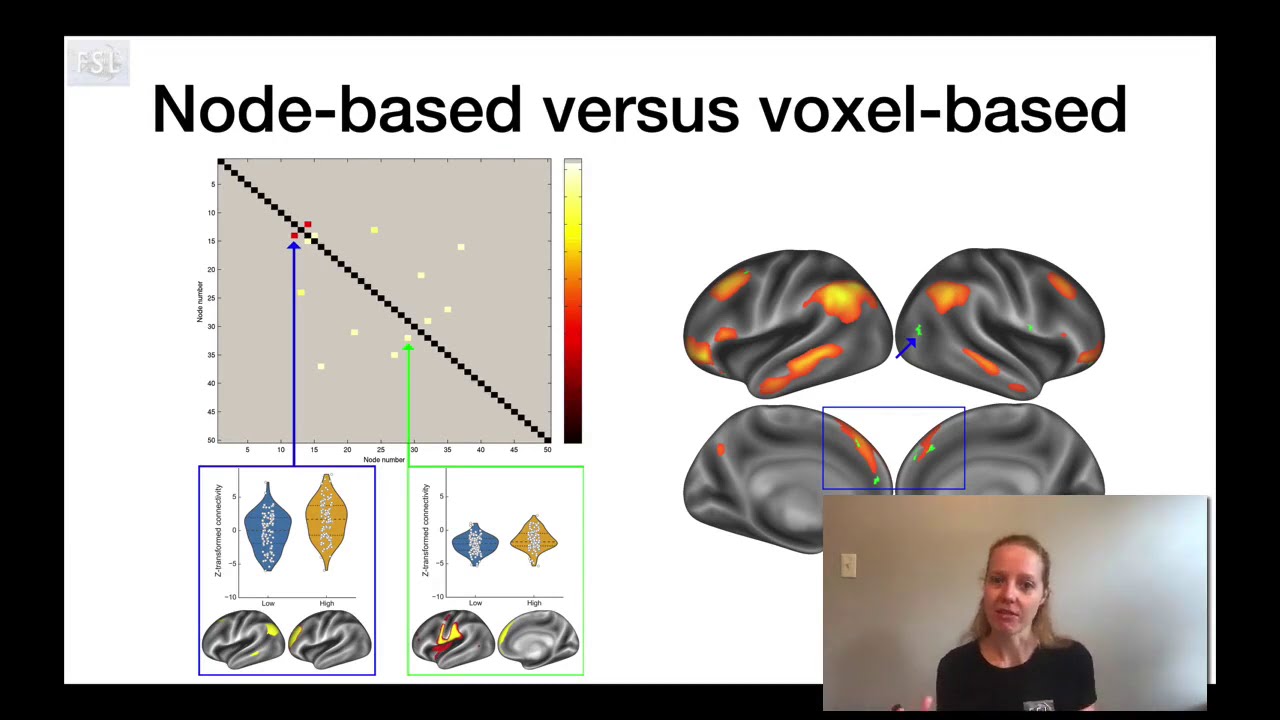 35. Resting State: Comparison of Resting State Methods (Nets E4)