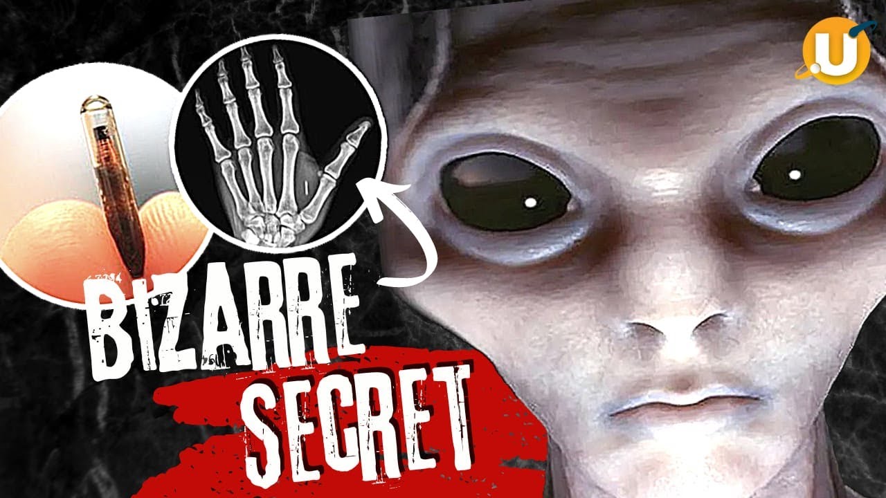 ALIEN implants have been FOUND in people