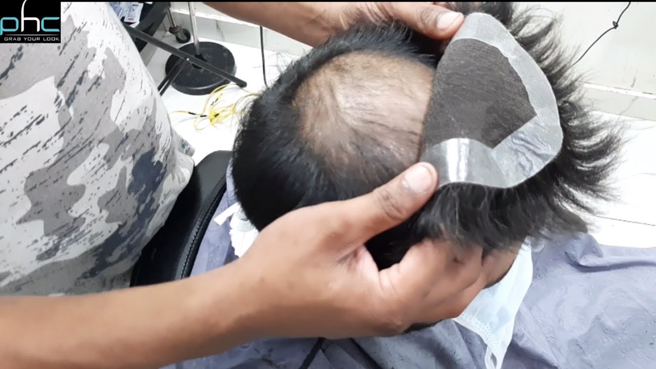 No Itching! No Redishness! How to do service of Hair Patch with Neat & Clean Scalp Call 9899746489