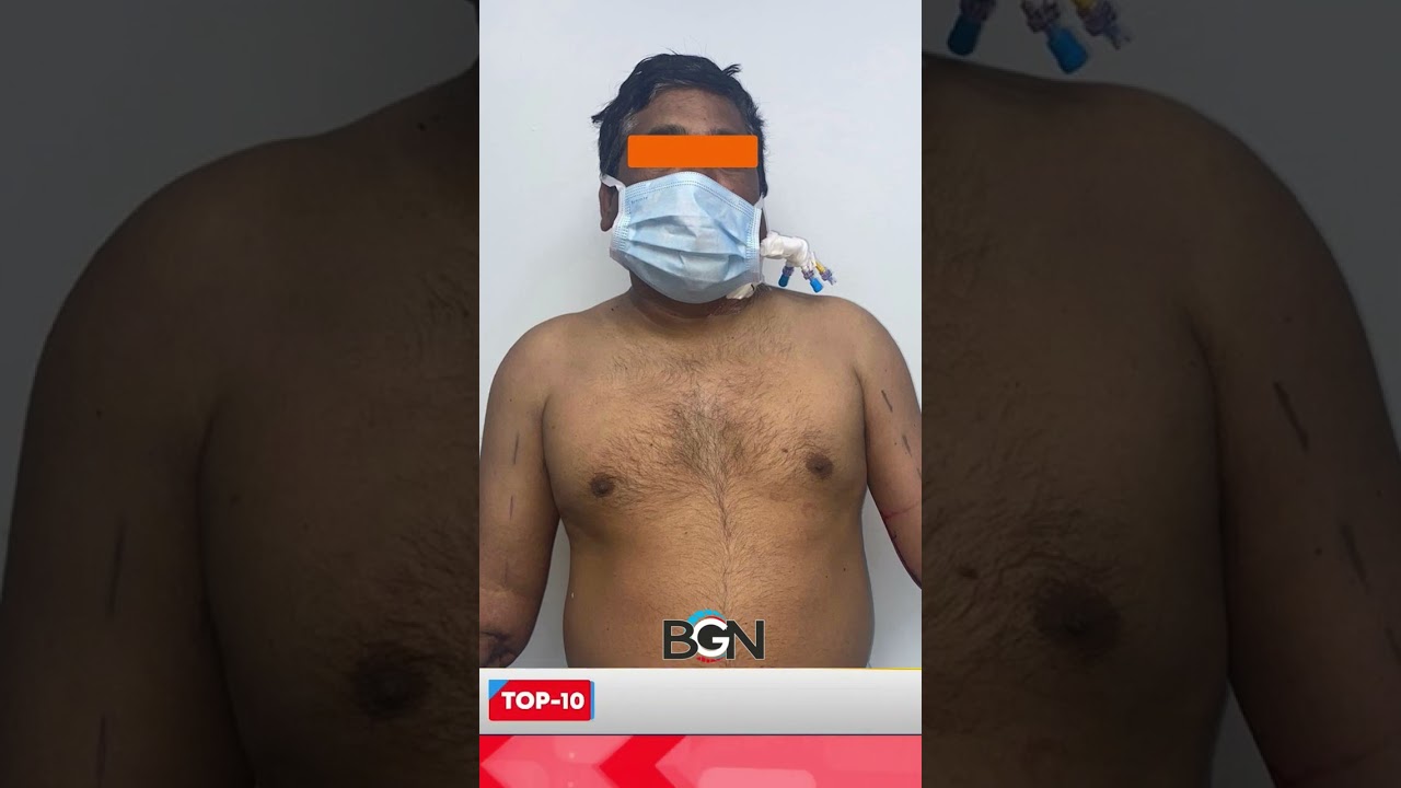 Double Hand Transplant Surgery Gives Delhi Painter New Hope | Meena Mehtaorgan donation