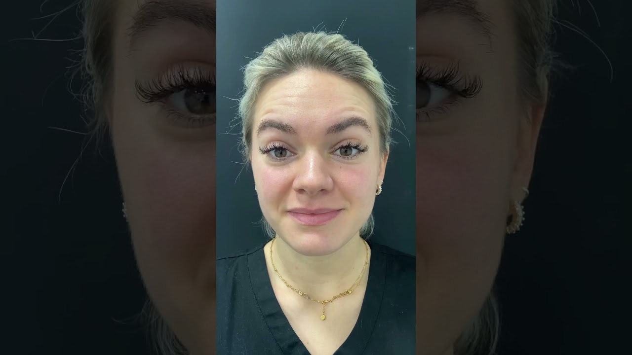 Here&rsquo;s what your Botox will look like over 7 days! 😱😍