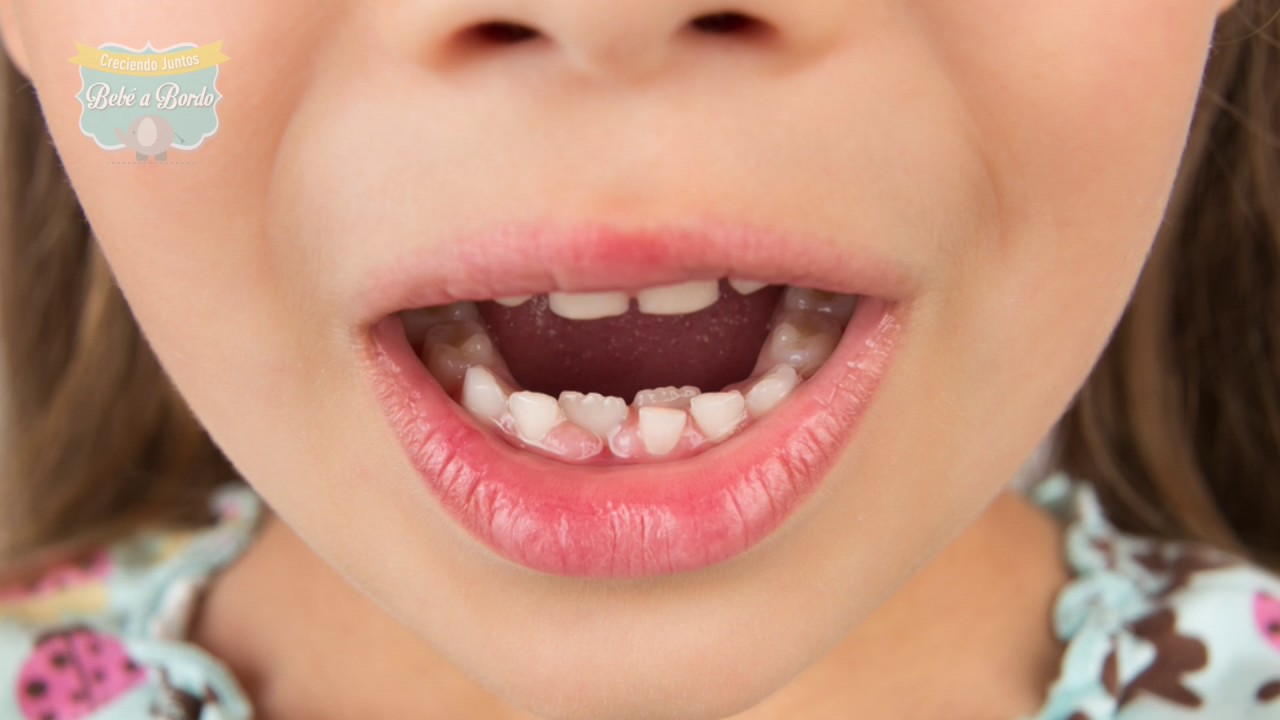 ¿Por qué no se la han caído los dientes a mi hijo?