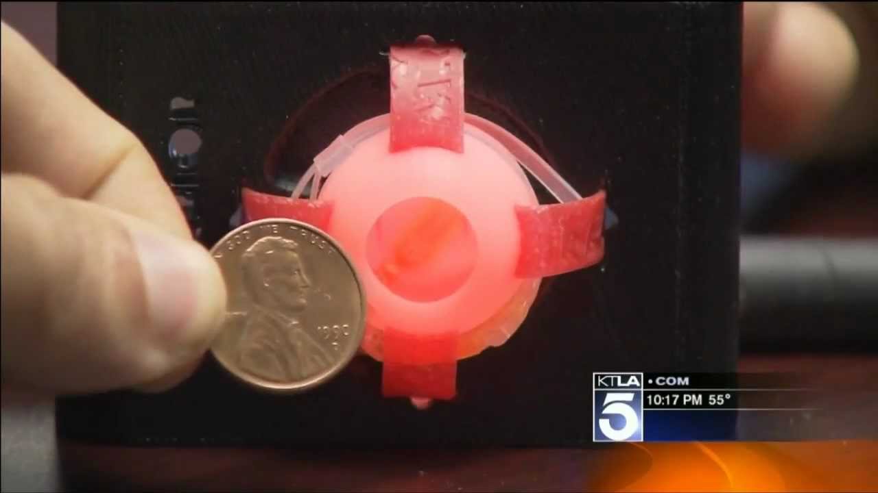 Bionic Eye Cures Blindness (EMMY® Award Winner)