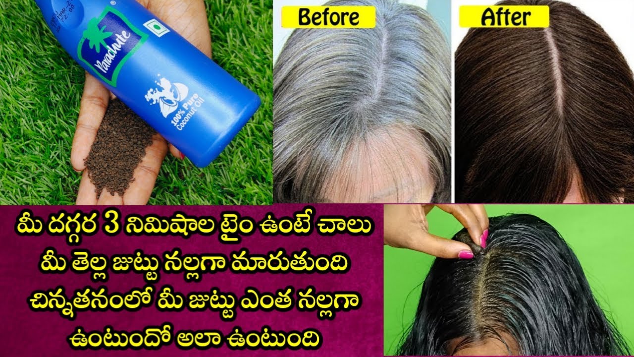 తెల్ల జుట్టు నల్లగా మారాలన్న, తెల్ల వెంట్రుకలు రాకుండా ఉండాలన్న, ఈ నూనె రాసుకోండి చాలు |  100% Work