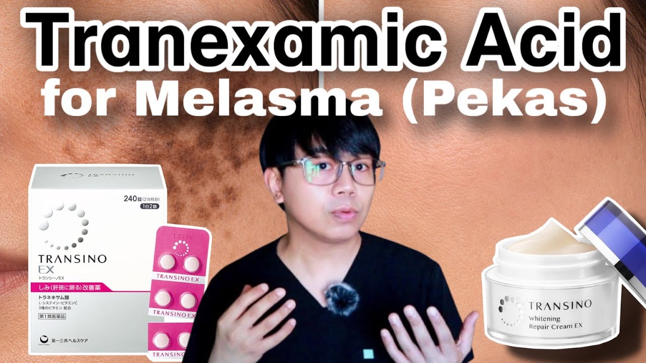 Does ORAL TRANEXAMIC ACID work for MELASMA (PEKAS)? | Nurse Explains...