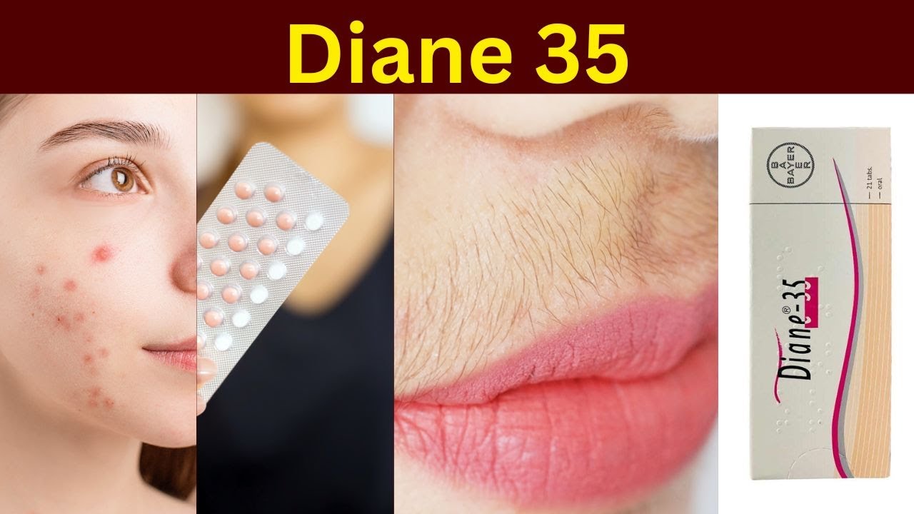 Таблетки Диане 35 | Обзор таблеток Диане 35 | Как применять таблетки Диане | Диане 35 | Побочные ...