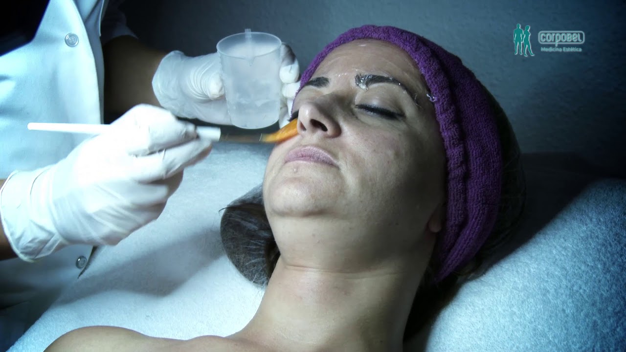 Testimonio de Tratamiento de Hifu Facial en Corpobel Salamanca