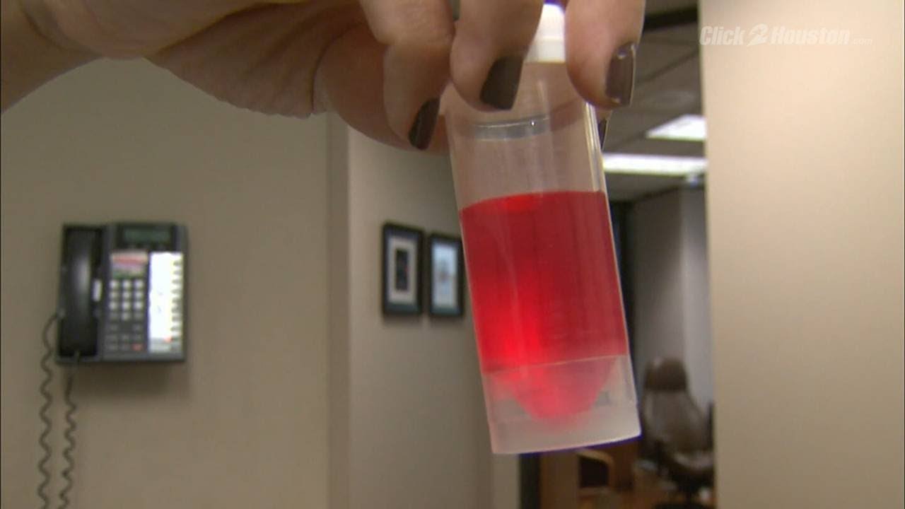 Saving children's teeth for stem cells