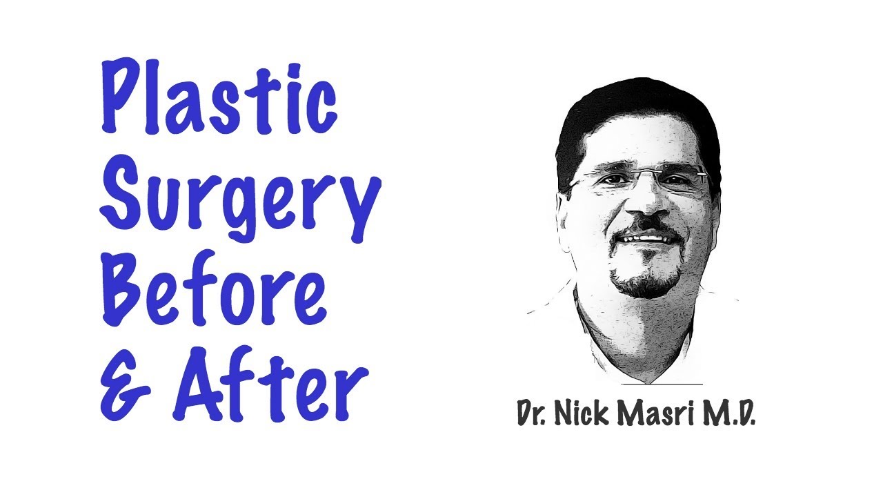 Plastic Surgery Before and After