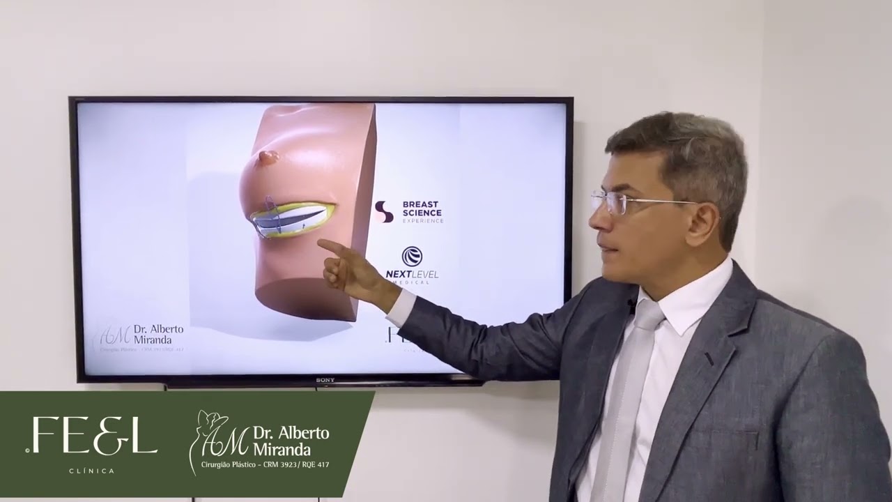DR. ALBERTO MIRANDA - A TÉCNICA DO SUTIÃ INTERNO - #shorts