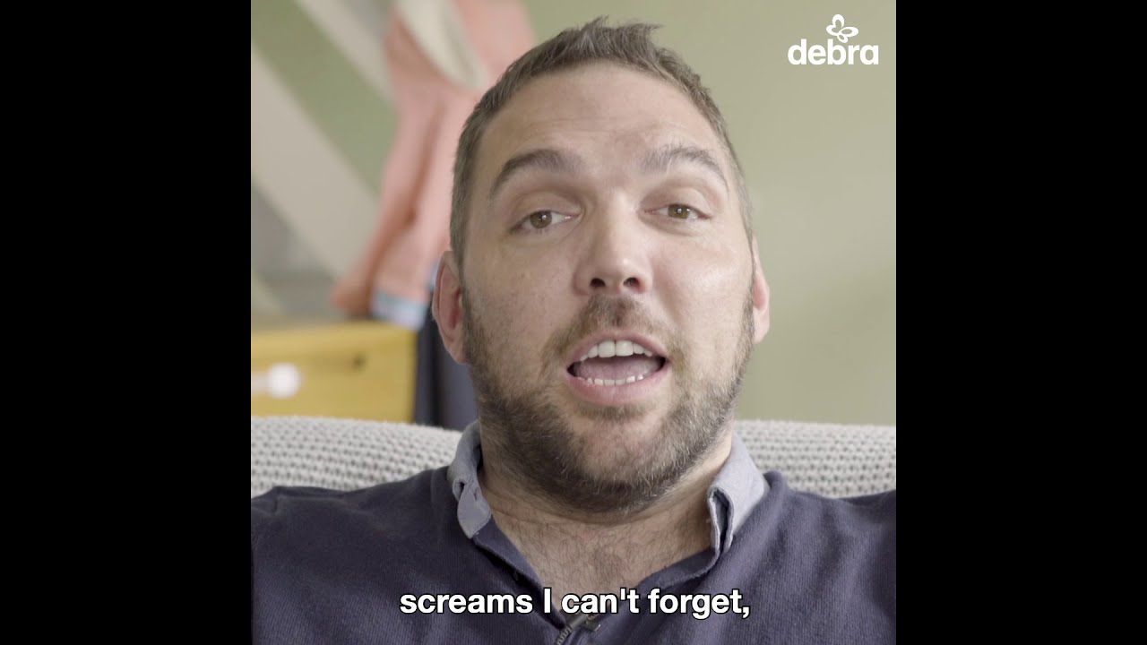 What is EB to me? - Simon Talbot #EBAwarenessWeek