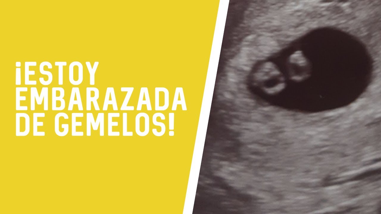 ¡ESTOY EMBARAZADA DE GEMELOS! -- Embarazo gemelar --