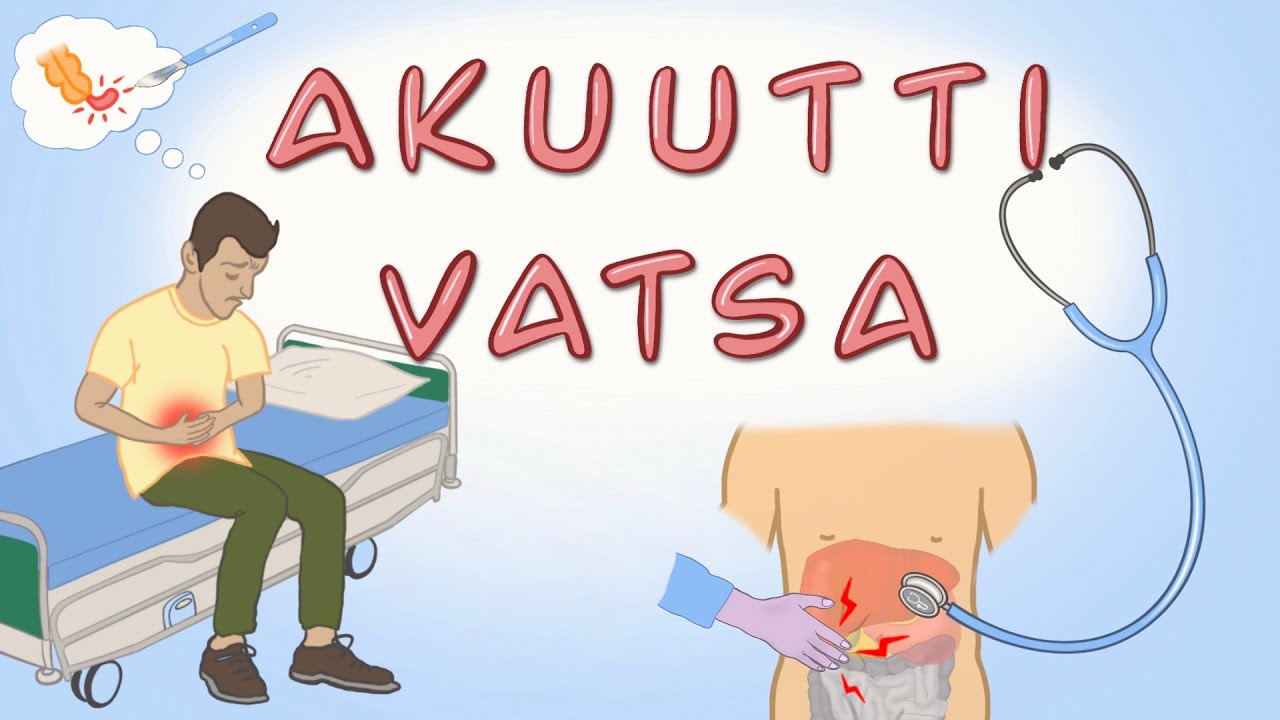 Akuutti vatsa