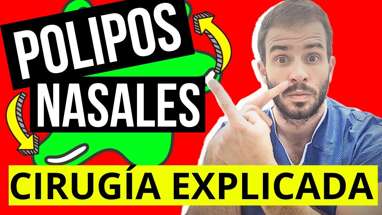✅CIRUGÍA de los PÓLIPOS NASALES👃: Riesgos , beneficios y postoperatorio
