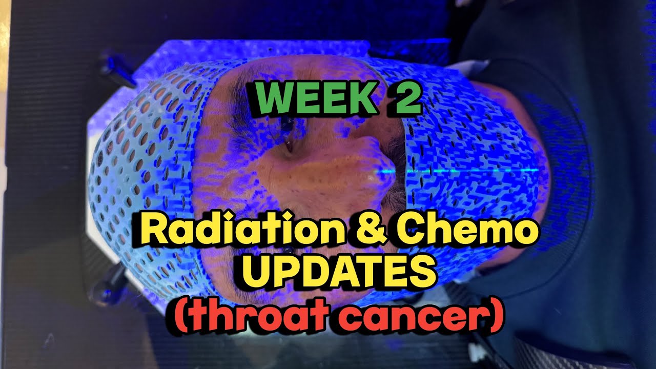 Radiation & Chemo Side Effects (Squamous Cell Carcinoma - Throat Cancer) Week 2