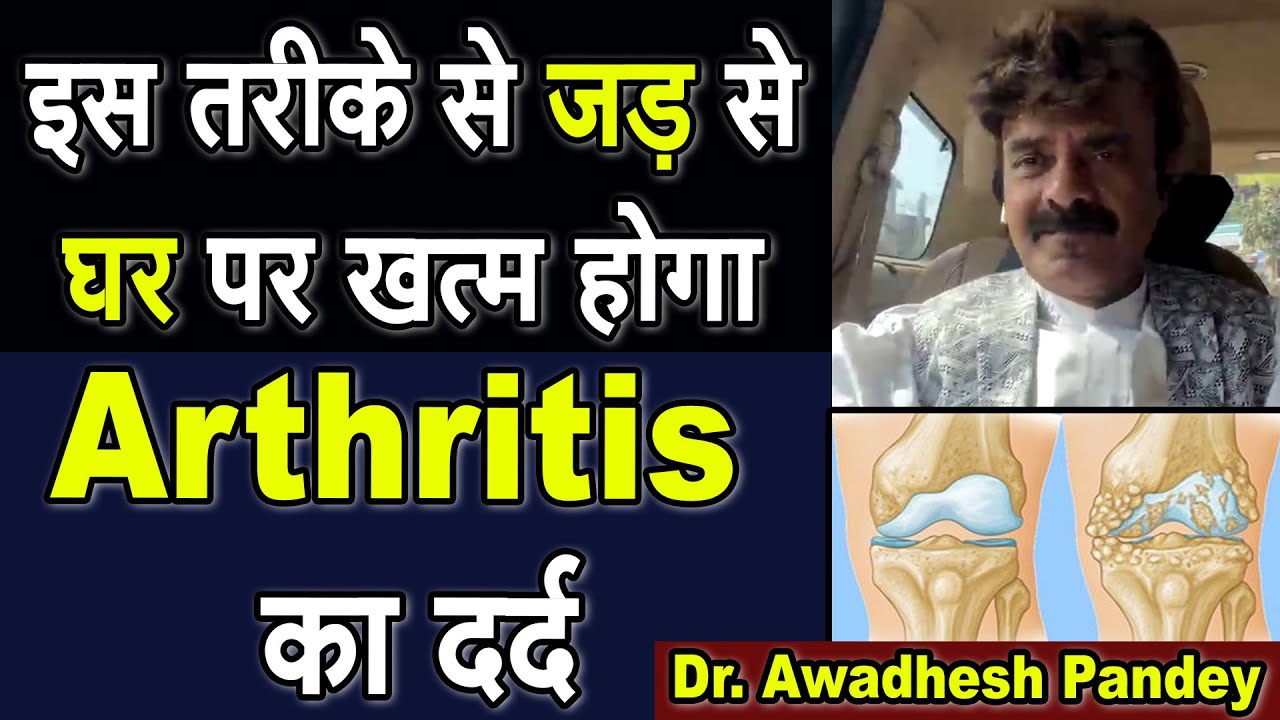 इस तरीके से जड़ से घर पर खत्म होगा Arthritis का दर्द | Dr. Awadhesh Pandey