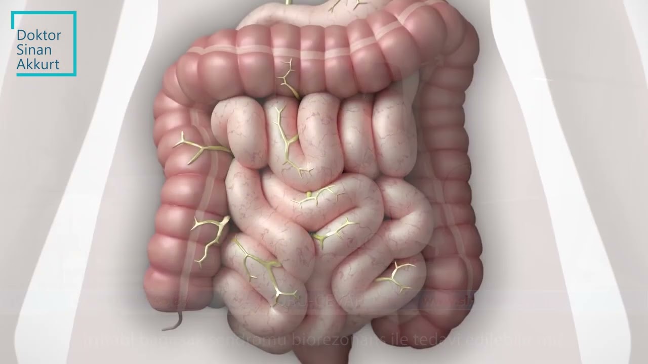 İrritabl bağırsak sendromu biorezonans ile tedavi edilebilir mi?