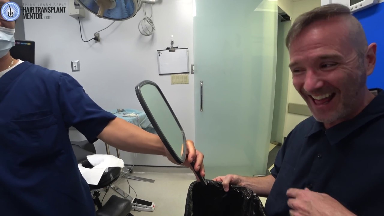 TEN Hair Transplants??? Joe Tillman Has an FUE Hair Transplant