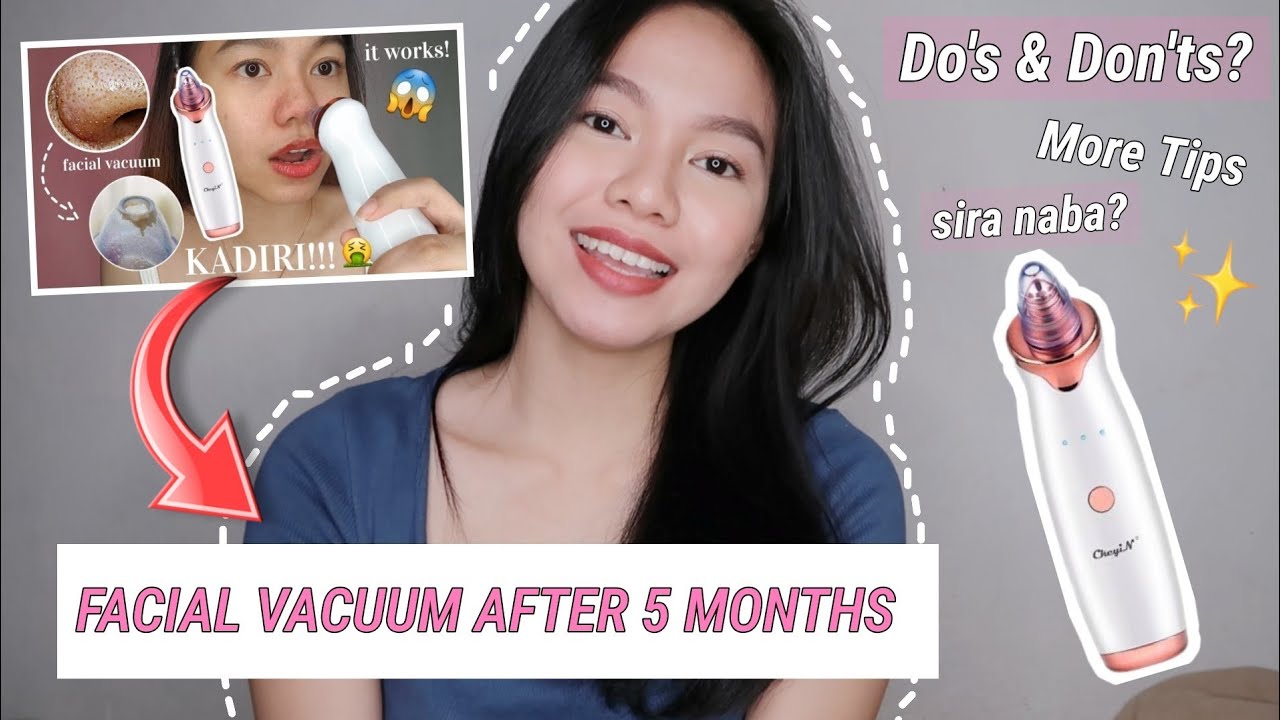 PORE VACUUM BLACKHEADS REMOVER 5 MONTHS UPDATE + Do's and Don'ts | Tips | Hello Katy