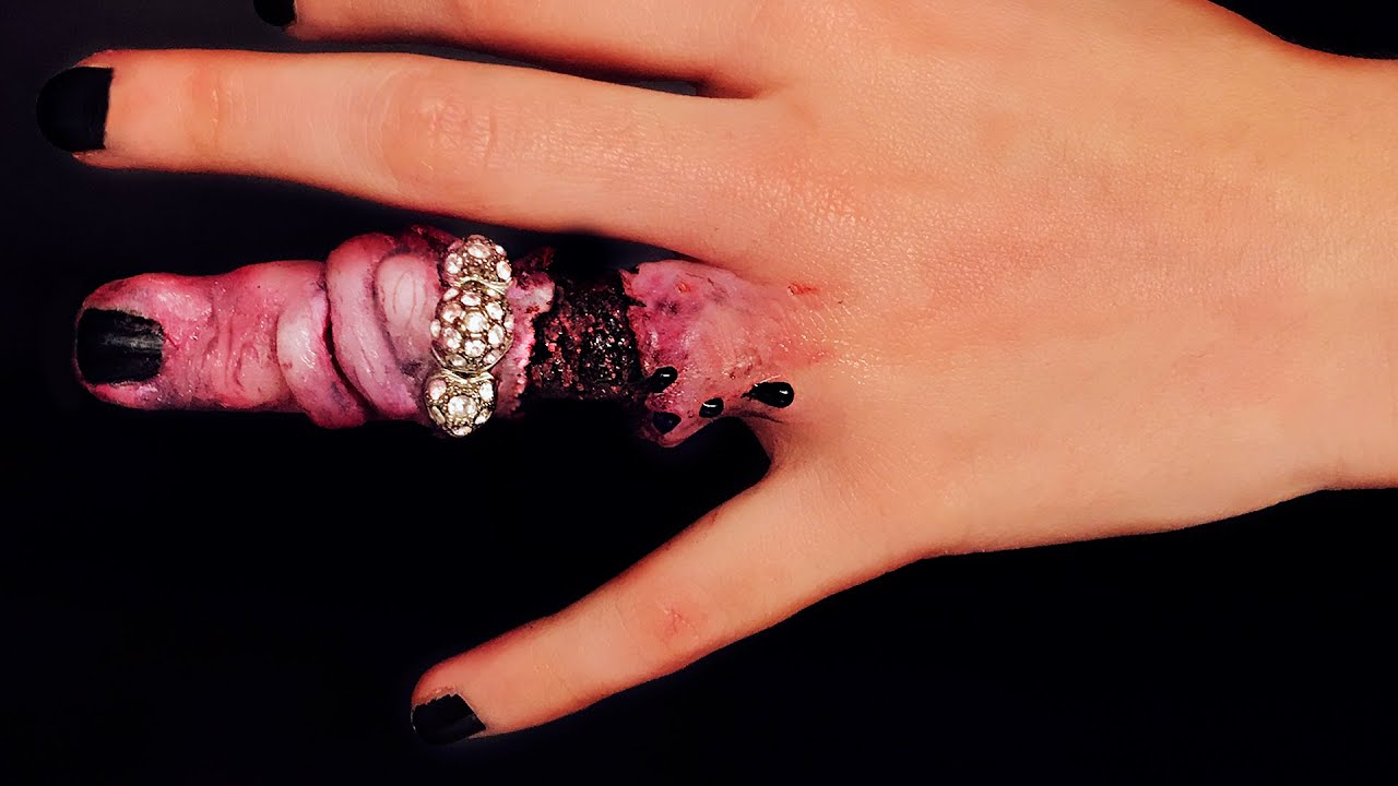 PIEL DESGARRADA Y AMORATADA AL QUITAR ANILLO - Makeup FX