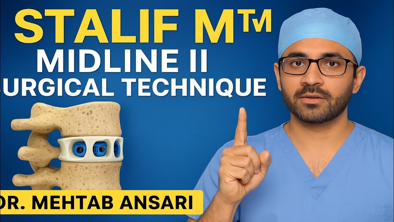 STALIF M&trade; MIDLINE II Surgical Technique | नई स्पाइन सर्जरी तकनीक | Anterior Lumbar Fusion Explained